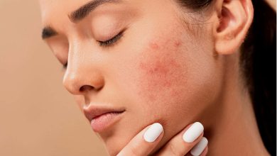 Why does glutathione cause acne breakouts