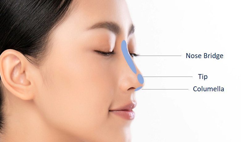 Pros and Cons of Non-Surgical Nose Job in Dubai