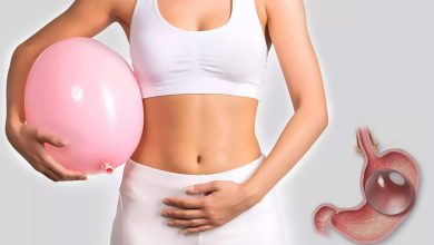 Gastric Balloon in Dubai